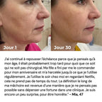 Lumilift | Appareil de lifting visage & cou