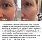 Lumilift | Appareil de lifting visage & cou