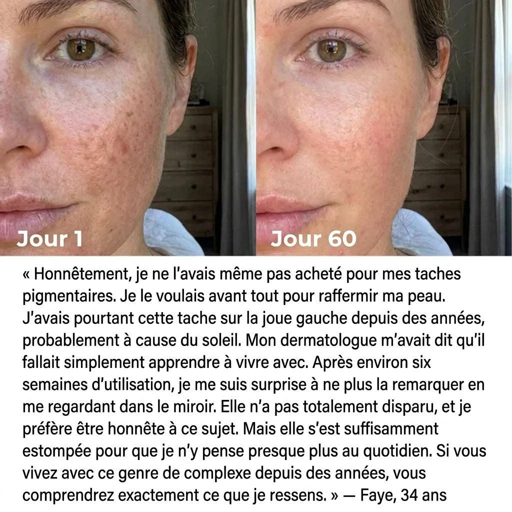 Lumilift | Appareil de lifting visage & cou