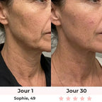 Lumilift | Appareil de lifting visage & cou