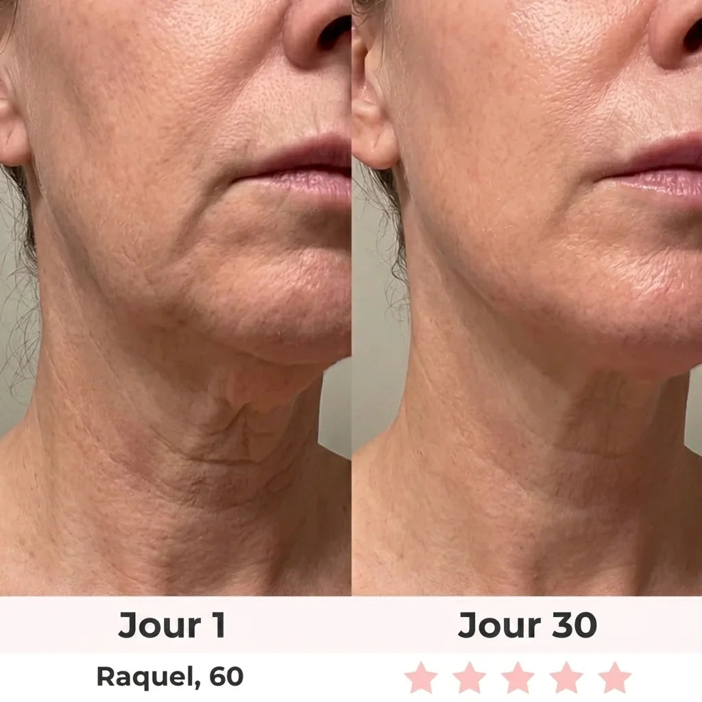 Lumilift | Appareil de lifting visage & cou