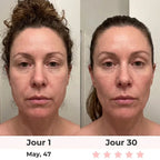 Lumilift | Appareil de lifting visage & cou