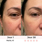 Lumilift | Appareil de lifting visage & cou
