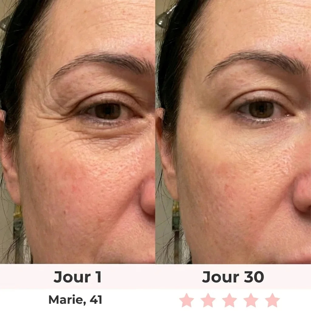 Lumilift | Appareil de lifting visage & cou