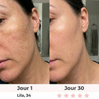 Lumilift | Appareil de lifting visage & cou