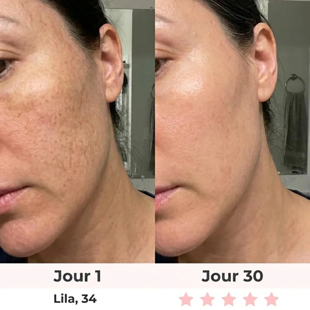 Lumilift | Appareil de lifting visage & cou